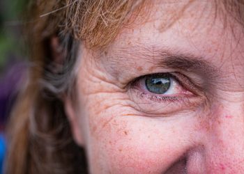Cum să previi îmbătrânirea prematură a pielii