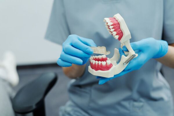 Medic stomatolog prezentând aparat dentar transparent pe model